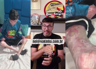 Dino Sonso mostra o sofrimento de Nei, menino de 10 anos, que pede a Deus: “Que me leve”, e mobiliza campanha na Vakinha para salvar sua vida